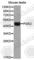 Phosphoglycerate Kinase 2 antibody, A4017, ABclonal Technology, Western Blot image 