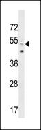 ArfGAP With FG Repeats 2 antibody, LS-C161018, Lifespan Biosciences, Western Blot image 