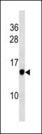 Proteasome Maturation Protein antibody, LS-C203896, Lifespan Biosciences, Western Blot image 