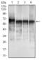 Keratin 5 antibody, GTX60749, GeneTex, Western Blot image 