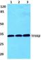 General Transcription Factor IIE Subunit 2 antibody, A11325-1, Boster Biological Technology, Western Blot image 