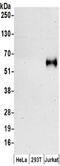 CD226 Molecule antibody, NBP2-32247, Novus Biologicals, Western Blot image 