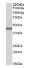 Atypical Chemokine Receptor 3 antibody, orb308864, Biorbyt, Western Blot image 