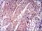 Kelch Like ECH Associated Protein 1 antibody, GTX60664, GeneTex, Immunohistochemistry paraffin image 