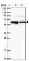 Leucine Rich Repeat Containing 1 antibody, PA5-56792, Invitrogen Antibodies, Western Blot image 