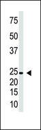 Interferon Lambda 1 antibody, 58-945, ProSci, Western Blot image 