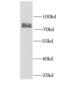 Factor Interacting With PAPOLA And CPSF1 antibody, FNab03131, FineTest, Western Blot image 