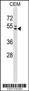 MUARP2 antibody, 59-206, ProSci, Western Blot image 