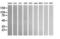 Aldehyde Dehydrogenase 1 Family Member A3 antibody, LS-C172936, Lifespan Biosciences, Western Blot image 