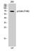 Ezrin antibody, STJ90569, St John