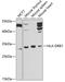 HLA class II histocompatibility antigen, DRB1-15 beta chain antibody, GTX55662, GeneTex, Western Blot image 
