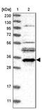 ER Membrane Protein Complex Subunit 2 antibody, PA5-54617, Invitrogen Antibodies, Western Blot image 