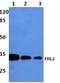 Four And A Half LIM Domains 2 antibody, A02129, Boster Biological Technology, Western Blot image 