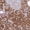 Zinc Finger Protein 510 antibody, NBP2-13578, Novus Biologicals, Immunohistochemistry paraffin image 