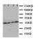 Stimulated by retinoic acid gene 8 protein antibody, orb76199, Biorbyt, Western Blot image 