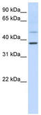 POU Class 6 Homeobox 1 antibody, TA342421, Origene, Western Blot image 