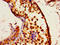 Inositol 1,4,5-Trisphosphate Receptor Type 1 antibody, LS-C673344, Lifespan Biosciences, Immunohistochemistry paraffin image 