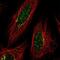 Thymidine Phosphorylase antibody, NBP2-55129, Novus Biologicals, Immunofluorescence image 