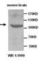 ADAM Metallopeptidase With Thrombospondin Type 1 Motif 1 antibody, orb76985, Biorbyt, Western Blot image 