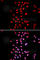 Dyskerin Pseudouridine Synthase 1 antibody, A1862, ABclonal Technology, Immunofluorescence image 