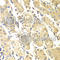 Programmed Cell Death 2 Like antibody, A7394, ABclonal Technology, Immunohistochemistry paraffin image 
