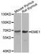 Essential Meiotic Structure-Specific Endonuclease 1 antibody, orb374085, Biorbyt, Western Blot image 