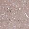 NUMB Like Endocytic Adaptor Protein antibody, NBP2-34104, Novus Biologicals, Immunohistochemistry frozen image 