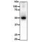 Aldehyde Dehydrogenase 5 Family Member A1 antibody, GTX57651, GeneTex, Western Blot image 