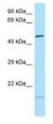 IKAROS Family Zinc Finger 1 antibody, NBP1-98314, Novus Biologicals, Western Blot image 