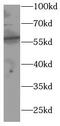 Glycerol Kinase antibody, FNab10019, FineTest, Western Blot image 