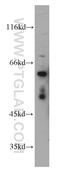 Growth Factor Receptor Bound Protein 10 antibody, 10028-2-AP, Proteintech Group, Western Blot image 