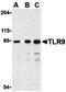 Toll Like Receptor 9 antibody, orb86840, Biorbyt, Western Blot image 