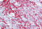 Keratin 17 antibody, MBS247528, MyBioSource, Immunohistochemistry paraffin image 