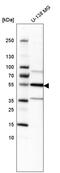 CD121a antibody, HPA005823, Atlas Antibodies, Western Blot image 