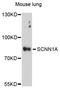 Amiloride-sensitive sodium channel subunit alpha antibody, STJ27489, St John