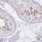Regulatory Factor X2 antibody, NBP2-13224, Novus Biologicals, Immunohistochemistry frozen image 