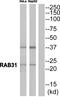 RAB31, Member RAS Oncogene Family antibody, PA5-39401, Invitrogen Antibodies, Western Blot image 