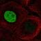 Smoothelin antibody, PA5-63590, Invitrogen Antibodies, Immunofluorescence image 