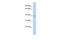 Transmembrane And Coiled-Coil Domain Family 1 antibody, NBP1-59392, Novus Biologicals, Western Blot image 