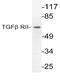 Transforming Growth Factor Beta Receptor 2 antibody, AP06349PU-N, Origene, Western Blot image 