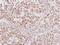 Zinc finger protein GLI3 antibody, NBP2-16665, Novus Biologicals, Immunohistochemistry paraffin image 