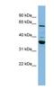 Cytochrome P450 Family 3 Subfamily A Member 7 antibody, NBP1-62676, Novus Biologicals, Western Blot image 