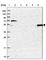 SET Domain Containing 6, Protein Lysine Methyltransferase antibody, HPA041481, Atlas Antibodies, Western Blot image 