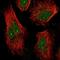 NUAK Family Kinase 1 antibody, NBP2-58038, Novus Biologicals, Immunofluorescence image 