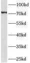 Growth Hormone Receptor antibody, FNab10122, FineTest, Western Blot image 