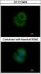 Coronin 2B antibody, GTX115405, GeneTex, Immunocytochemistry image 