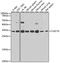 C-Type Lectin Domain Containing 7A antibody, A9883, ABclonal Technology, Western Blot image 