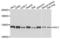 ATP Citrate Lyase antibody, LS-C411408, Lifespan Biosciences, Western Blot image 