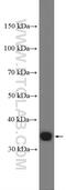 Potassium Channel Tetramerization Domain Containing 10 antibody, 27279-1-AP, Proteintech Group, Western Blot image 