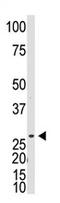 Dickkopf Like Acrosomal Protein 1 antibody, AP11559PU-N, Origene, Western Blot image 